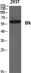 Western blot analysis of various cells using Anti-BLK Antibody