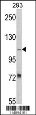 Anti-AASS Rabbit Polyclonal Antibody