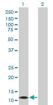 Anti-CALML3 Rabbit Polyclonal Antibody