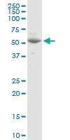 Anti-VANGL1 Rabbit Polyclonal Antibody