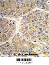 Anti-AASS Rabbit Polyclonal Antibody