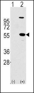 Anti-ALDH1A1 Rabbit Polyclonal Antibody (AP (Alkaline Phosphatase))