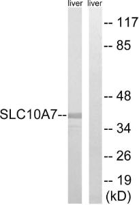 Anti-SLC10A7 Rabbit Polyclonal Antibody