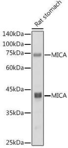 Western blot analysis of extracts of Rat stomach, using Anti-MICA Antibody [ARC2422] (A306195) at 1:1,000 dilution The secondary antibody was Goat Anti-Rabbit IgG H&L Antibody (HRP) at 1:10,000 dilution Lysates/proteins were present at 25 µg per lane