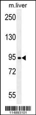 Anti-AASS Rabbit Polyclonal Antibody