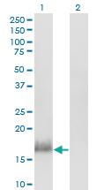 Anti-CALML3 Mouse Monoclonal Antibody [clone: 2A11]