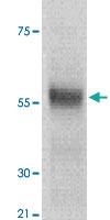 Anti-TP53 Rabbit Polyclonal Antibody