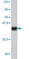 Anti-CDX4 Mouse Monoclonal Antibody [clone: 2E11]