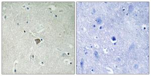 Immunohistochemical analysis of paraffin-embedded human brain tissue using Anti-Bax Antibody. The right hand panel represents a negative control, where the antibody was pre-incubated with the immunising peptide.