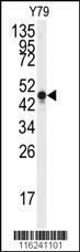 Anti-NSE Rabbit Polyclonal Antibody