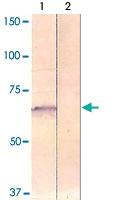 Anti-PAK4 Rabbit Polyclonal Antibody