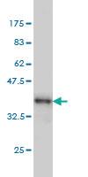 Anti-PIK3CB Mouse Monoclonal Antibody [clone: 4H2]