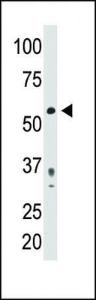 Anti-PDX1 Rabbit Polyclonal Antibody (Biotin)