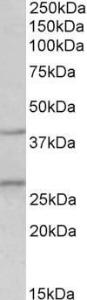 Antibody anti-FGF23 100 µg