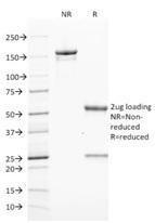 Anti-ZAP70 antibody