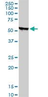 Anti-STK38 Mouse Monoclonal Antibody [clone: 2G8-1F3]