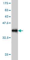 Anti-SIK2 Mouse Monoclonal Antibody [clone: 4H6]