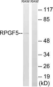 Western blot analysis of lysates from RAW2647 cells using Anti-RAPGEF5 Antibody The right hand lane represents a negative control, where the antibody is blocked by the immunising peptide