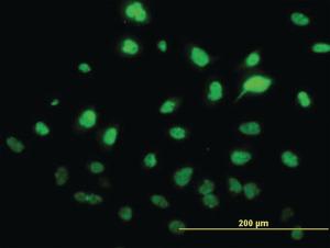 Anti-SAE1 Mouse Monoclonal Antibody [clone: 1G4-1G5]