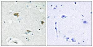 Immunohistochemical analysis of paraffin-embedded human brain tissue using Anti-BAD Antibody. The right hand panel represents a negative control, where the antibody was pre-incubated with the immunising peptide