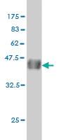 Anti-CDX4 Mouse Monoclonal Antibody [clone: 2G12]