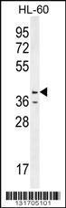 Anti-CASP12 Rabbit Polyclonal Antibody (Biotin)