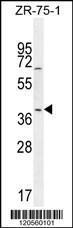 Anti-JUNB Rabbit Polyclonal Antibody (Biotin)