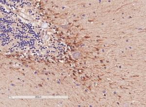 Anti-COMT antibody