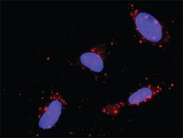 Anti-BID + RHOA Antibody Pair