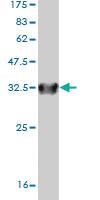 Anti-SLC6A20 Mouse Monoclonal Antibody [clone: 3G6]