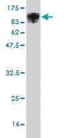 Anti-ALOX15 Mouse Monoclonal Antibody [clone: 3D8]