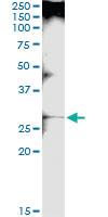 Anti-LGALS3 Polyclonal Antibody Pair