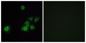 Immunofluorescence analysis of A549 cells using Anti-OR4C15 Antibody The right hand panel represents a negative control, where the antibody was pre-incubated with the immunising peptide