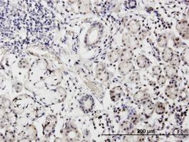 Anti-CALML3 Mouse Monoclonal Antibody [clone: 2A11]