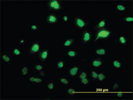 Anti-SAE1 Mouse Monoclonal Antibody [clone: 1G4-1G5]