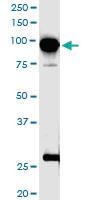 Anti-TTK Rabbit Polyclonal Antibody