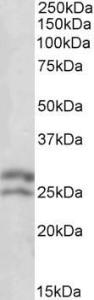 Anti-BCL2 Antibody (A83362) (0.1 µg/ml) staining of Human Lymph lysate (35 µg protein in RIPA buffer). Primary incubation was 1 hour. Detected by chemilu minescence