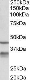 Antibody anti-HSD11B1 100 µg