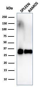 Western blot analysis of Ramos cell and human spleen tissue lysates using Anti-HLA DRB Antibody [SPM289]