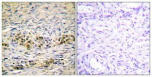 Immunohistochemical analysis of paraffin-embedded human ovary tissue using Anti-Akt Antibody. The right hand panel represents a negative control, where the Antibody was pre-incubated with the immunising peptide