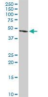 Anti-FGL2 Rabbit Polyclonal Antibody