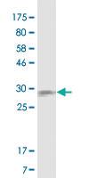 Anti-CD40 Mouse Monoclonal Antibody [clone: 4F11]