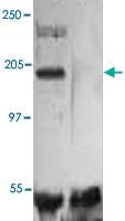 Anti-KDR Rabbit Polyclonal Antibody