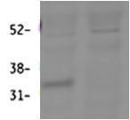 Antibody anti-HSD11B1 100 µg