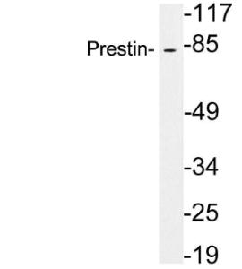 Western blot analysis of lysates from brain tissue using Anti-Prestin Antibody