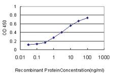 Anti-SAE1 Mouse Monoclonal Antibody [clone: 1G4-1G5]