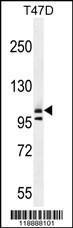 Anti-COL1A2 Rabbit Polyclonal Antibody (HRP (Horseradish Peroxidase))