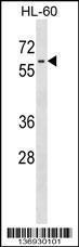 Anti-LIN9 Rabbit Polyclonal Antibody (HRP (Horseradish Peroxidase))