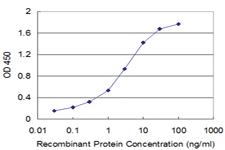 Anti-CALML3 Mouse Monoclonal Antibody [clone: 2A11]