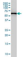 Anti-FARSB Mouse Monoclonal Antibody [clone: 2F11]